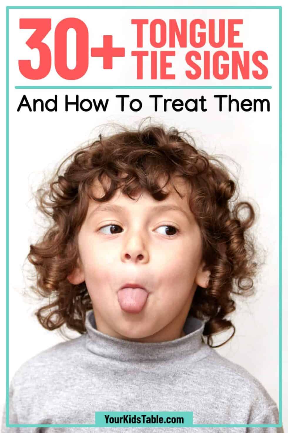 30-tongue-tie-signs-and-how-to-treat-them-your-kid-s-table